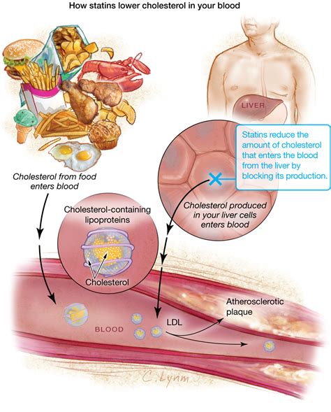 Statins | Cardiology | JAMA | The JAMA Network
