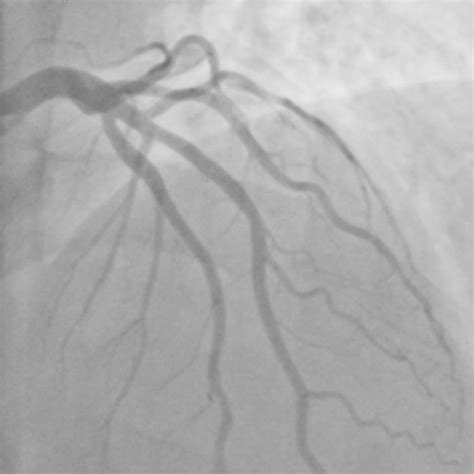 Stellenwert der Koronar-CT im klinischen Alltag - Kardiologie ...