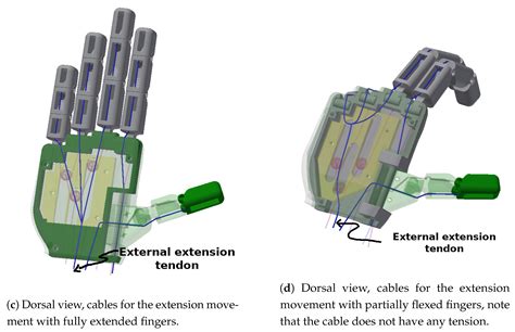 Development and Implementation of an Anthropomorphic Underactuated ...