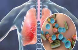 Pulmonologist in Faridabad | Best Lung Specialist - Dr.Ravi Shekhar Jha