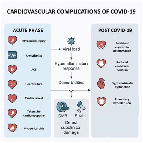 Cardiovascular Complications of COVID-19 Disease: A Narrative Review