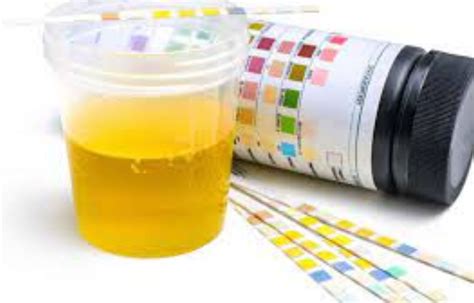 Steroid plus tacrolimus highly effective for Idiopathic Membranous ...