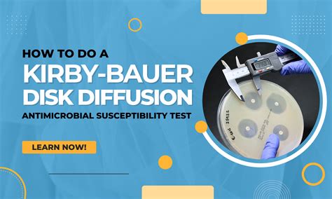 How to do a Kirby Bauer Disk Diffusion Antimicrobial Susceptibility Test