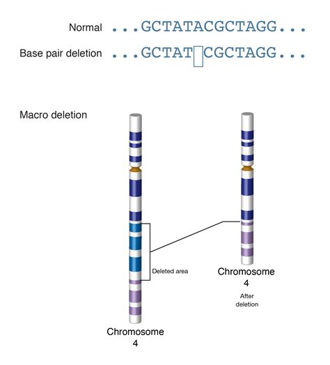Variant | Oncology Nursing Society