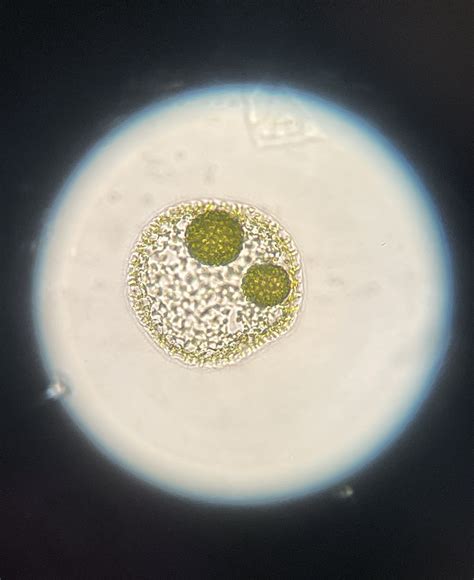 Volvox Under Microscope 100x Volvox Under A Microscope