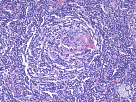 Kuvatulokset haulle castleman s disease specialist