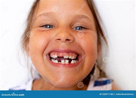 Toothless Smiling, Glad, Mischievous Girl Show Baby Temporary Milk ...