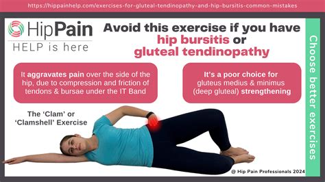 Exercises For Gluteal Tendinopathy And Hip Bursitis – ATZG
