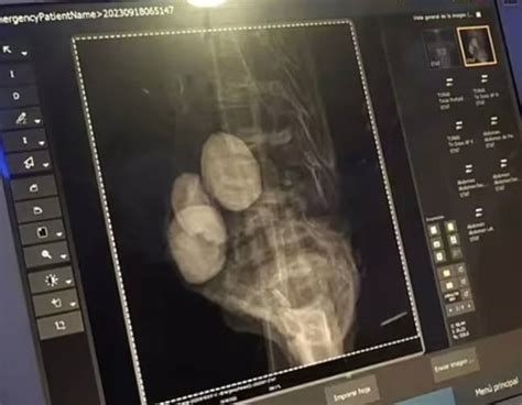 Image result for Alien Stomach Experiment Surgery