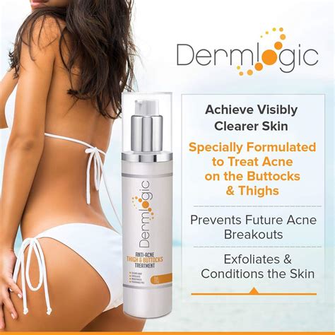 Anti-Acne Thigh & Buttocks Treatment - Clear Pimples & Ingrown Hairs, Prevent Breakouts - 6.09 ...