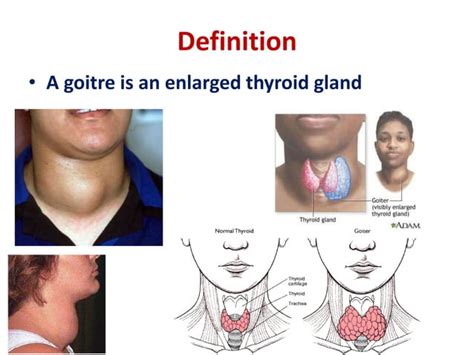 Image result for Thyroid Function Algorithm