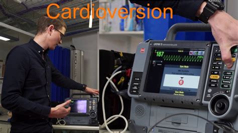 Image result for What Does Synchronized Cardioversion Do