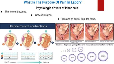 Causes Of Labor Pain