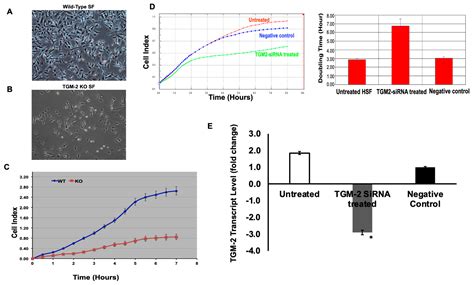 Molecular Basis of Transglutaminase-2 and Muscarinic Cholinergic ...