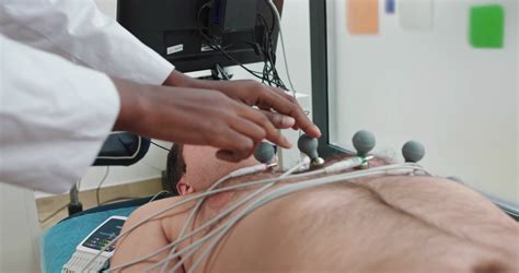 Cardiogram Procedure 的图像结果