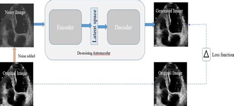 Image result for Denoising Autoencoder Code
