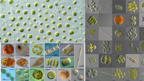 Rhizopus Under Microscope - Biology Notes Online