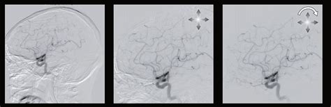 Canon Alphenix BiPlane купити в Україні | InMed