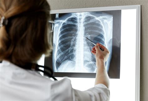 COPD Diagnosis: Lifestyle Changes To Make | The Well by Northwell