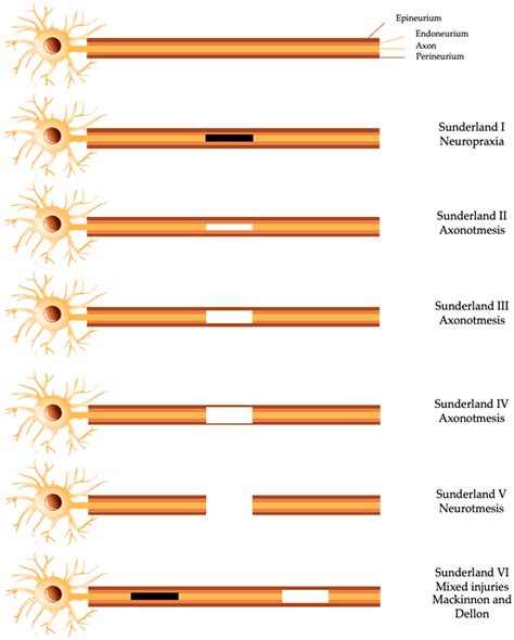 Peripheral Nerve Injury Treatments and Advances: One Health Perspective