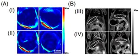 Dual-Mode Tumor Imaging Using Probes That Are Responsive to Hypoxia ...