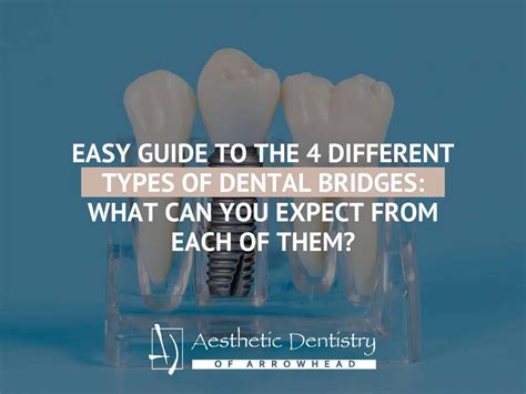 Aesthetic Dentistry Of Arrowhead | Glendale AZ Dentist