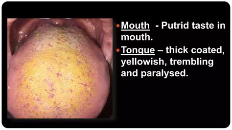 Putrid Taste In Mouth