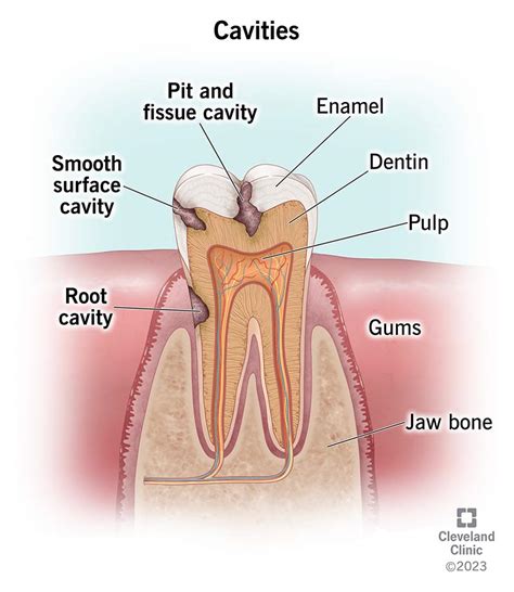Image result for Stumpy Black Teeth