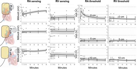Image result for Synchronized Cardioversion Pad Placement
