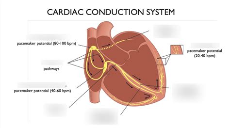 Image result for Cardiac Conduction Disorders Examples