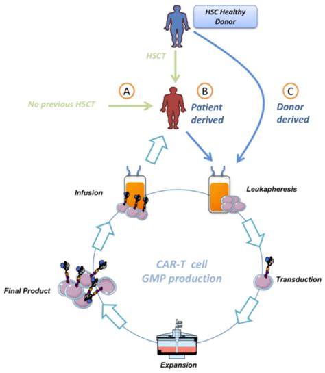CAR-T after Stem Cell Transplantation in B-Cell Lymphoproliferative ...
