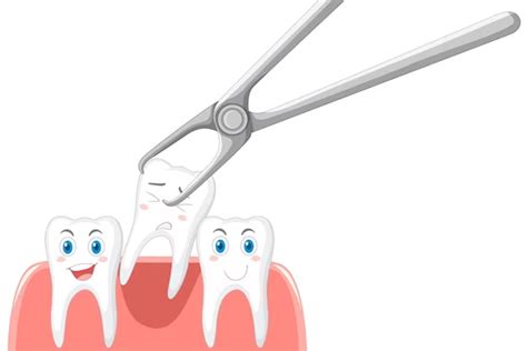 Simple vs. Surgical Tooth Extractions: Which Option is Right for You? - Pascack Dental Arts