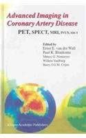 Buy Advanced Imaging in Coronary Artery Disease: PET, SPECT, MRI, IVUS ...