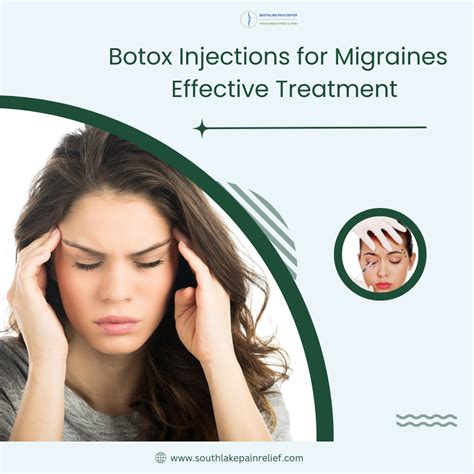Migraine Medication Botox at Ella Kendall blog