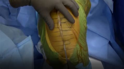 Image result for Real Brain Surgery Simulator