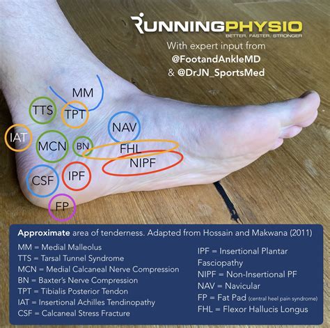 Plantar Fasciitis Heel Pain Online | bellvalefarms.com