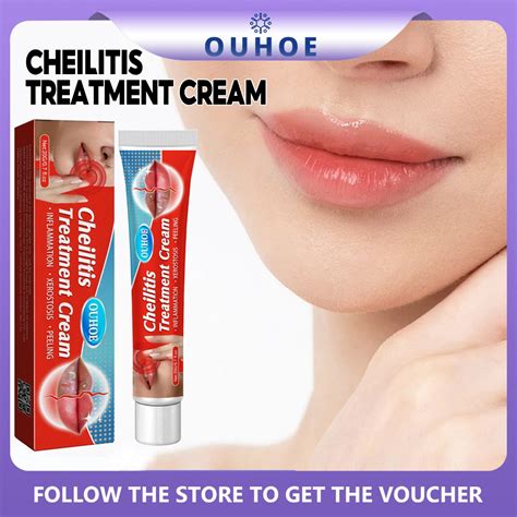 OUHOE Cheilitis Treatment Cream 20g Labial Herpes Antibacterial Ointment Chapped Peeling ...