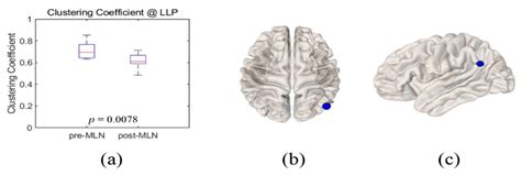 Comparison Analysis between the Medication Efficacy of the Milnacipran ...