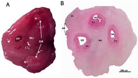 Use of Human Umbilical Vein Endothelial Cells (HUVEC) as a Model to ...
