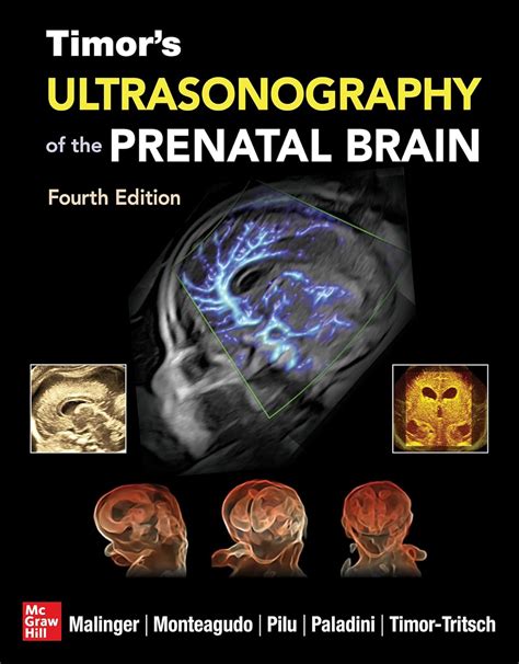 Buy Timor's Ultrasonography of the Prenatal Brain, Fourth Edition Book ...