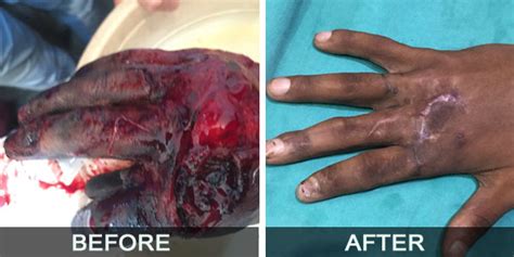 Aggarwal Hospital-Our Treatment History