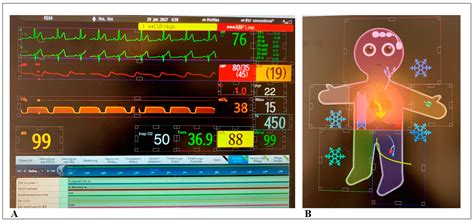 The Visual Patient Avatar ICU Facilitates Information Transfer of ...