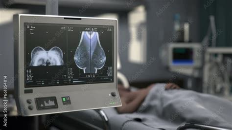 Hospital X-ray Chest 的图像结果