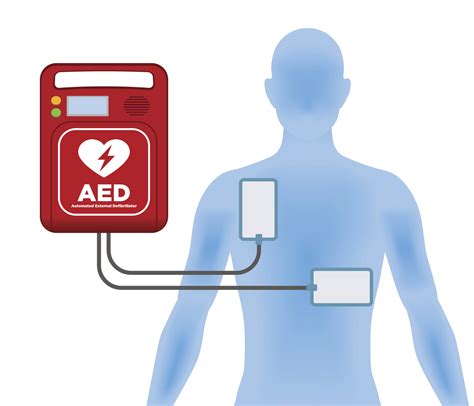 Using an AED UK 的图像结果