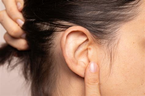 Lump Behind Ear Is It Cancer at Roxanna Sullivan blog