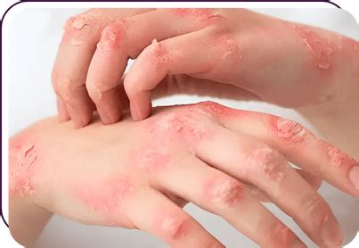 Home - Lifero Skin and Hair Clinic | Expert Dermatology & Hair Care ...