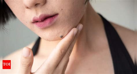 Astrological meaning of moles on the chin - Times of India