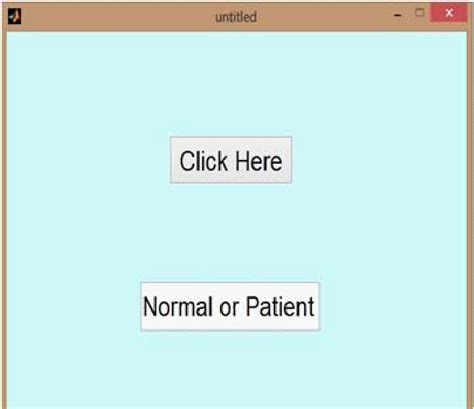 Image result for Open GUI Script Easy