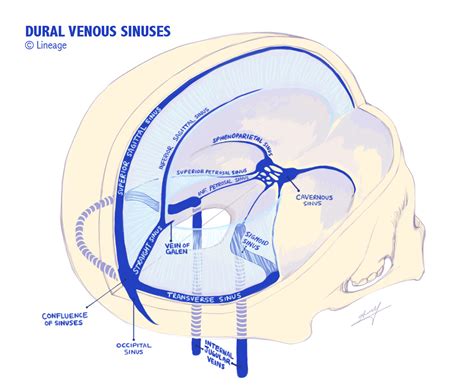 Dural Venous Sinuses - Neurology - Medbullets Step 1