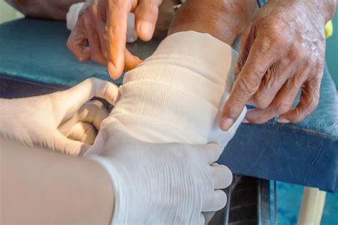 Infected Abscess Lanced 的图像结果